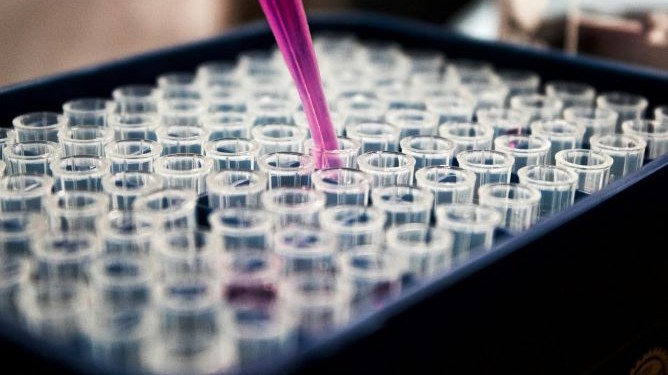 louis-reed-pwcKF7L4-no-unsplash